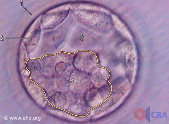 https://www.hli.org/wp-content/uploads/2019/05/early-blastocyst.jpg